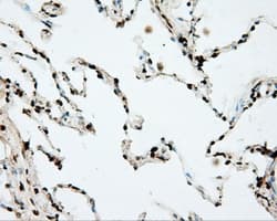DAPK2 / DAP Kinase 2 Antibody (clone OTI1C8)