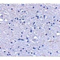 GRIK4 / KA1 Antibody