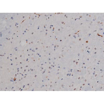 Polyclonal Rabbit anti-Human LYN Antibody (phospho-Tyr508, IHC, IF, WB)