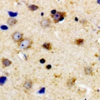 Polyclonal Rabbit anti-Human TPH1 / Tryptophan Hydroxylase Antibody (phospho-Ser58, IHC, WB)