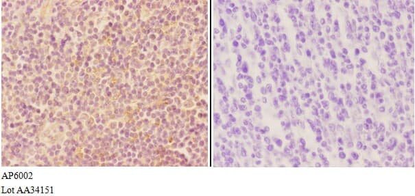 VWF / Von Willebrand Factor Antibody