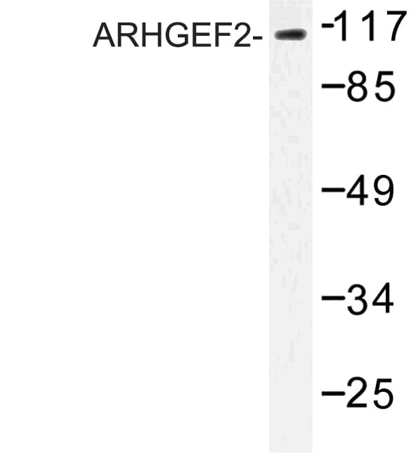 ARHGEF2 / GEF-H1 Antibody (Pro881)