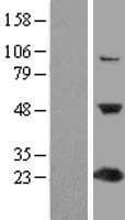 C1orf50 Protein (Over-Expression Lysate Myc-DDK (Flag))