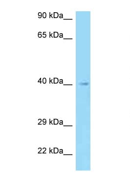 Polyclonal Rabbit anti-Human AADACL3 Antibody (aa31-80, WB)