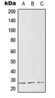 RGS5 Antibody (Internal)