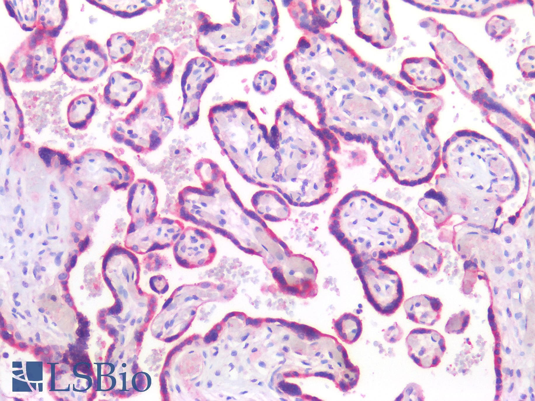 PathPlus™ SEMA3B / SemA Antibody (aa100-200)