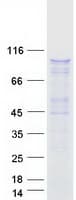 Human HELLS Protein (Recombinant Myc-DDK (Flag))