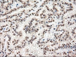 Monoclonal Mouse anti-Human MYC / c-Myc Antibody (clone OTI1A6, IHC, IF, WB)
