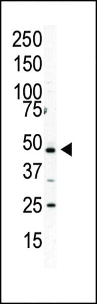 PIP4K2A / PIPK Antibody (aa303-335)