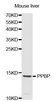 IHC-plus™ CXCL7 / PPBP Antibody