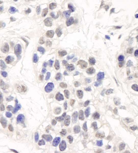DCLRE1C / Artemis Antibody (aa650-C-term)