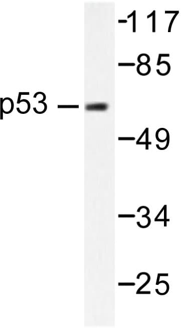 Polyclonal Rabbit anti-Human TP53 / p53 Antibody (Pro309, WB)