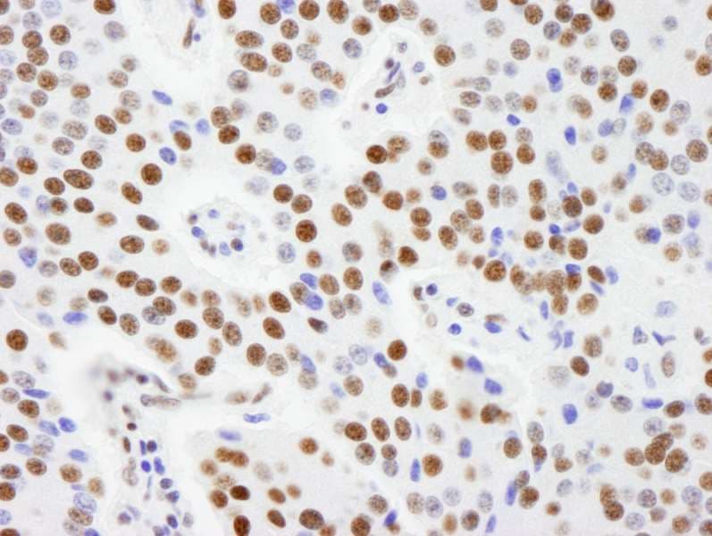 AKAP8L Antibody (aa596-646)