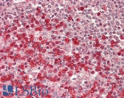 IHC-plus™ CLC-7 / CLCN7 Antibody (aa10-59)