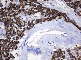 Monoclonal Mouse anti-Human NDUFB10 Antibody (clone OTI2G1, IHC, WB)