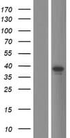 Human TRIM16L Protein (Over-Expression Lysate Myc-DDK (Flag))