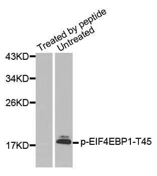 EIF4EBP1 / 4EBP1 Antibody (phospho-Thr45)