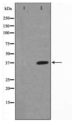 NFKBIA / IKB Alpha / IKBA Antibody (phospho-Ser32/Ser36)