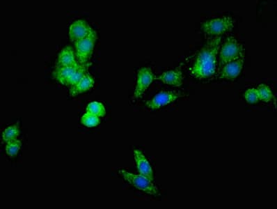 DIABLO / SMAC Antibody
