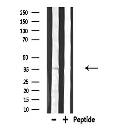 DGAT2L6 Antibody