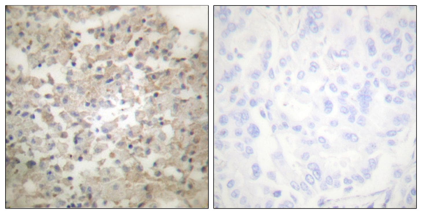 TPH1 / Tryptophan Hydroxylase Antibody (phospho-Ser260)