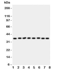 ANXA5 / Annexin V Antibody (aa2-320)