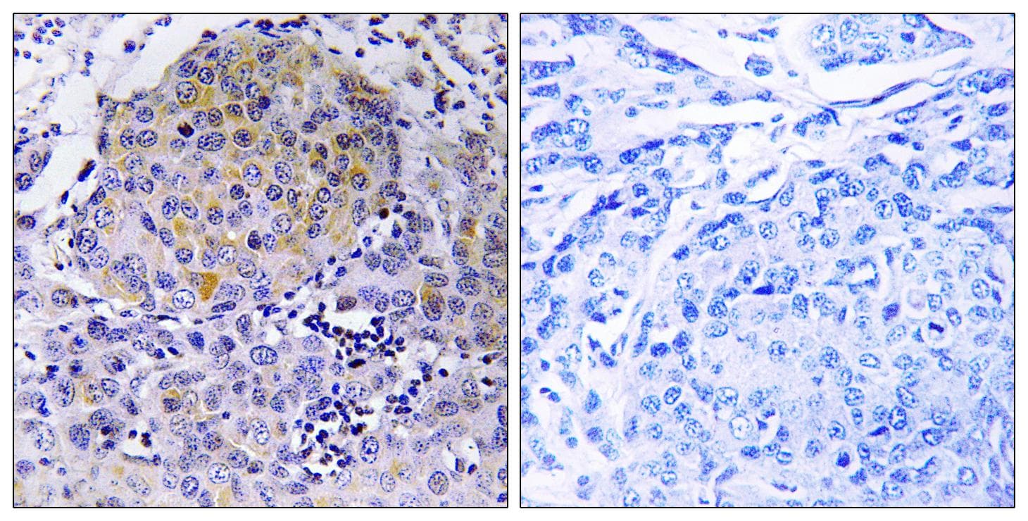CEP78 / IP63 Antibody