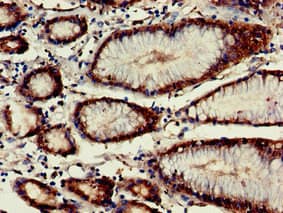 Polyclonal Rabbit anti-Human VASH2 Antibody (IHC, IF, WB)