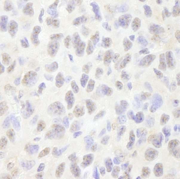 PDS5B / AS3 Antibody (aa1200-1250)