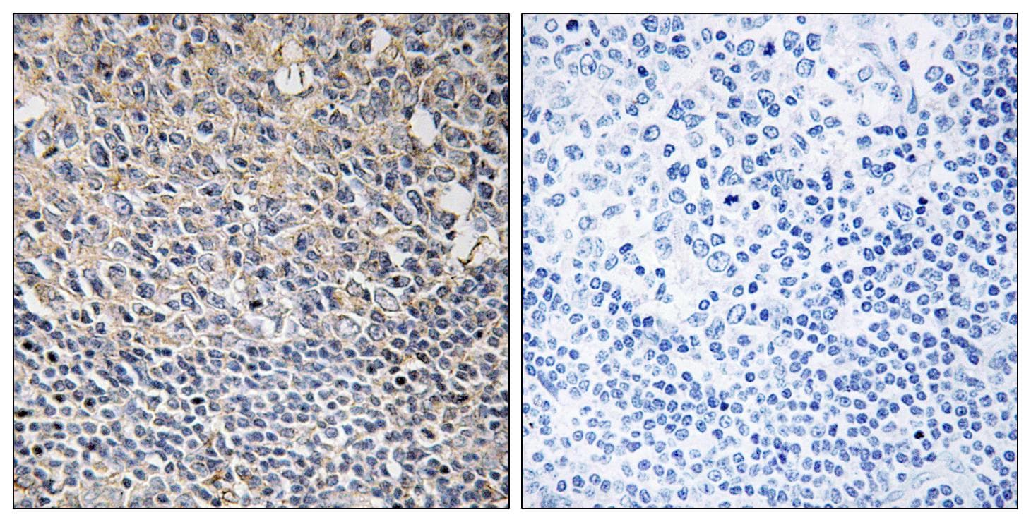 PLCG2 / PLC Gamma 2 Antibody (phospho-Tyr1217)