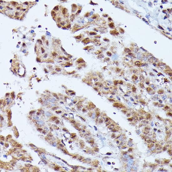 Polyclonal Rabbit anti-Human KIAA1429 Antibody (IHC)