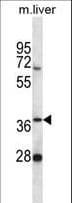 Polyclonal Rabbit anti-Human PNKD Antibody (aa42-70, IHC, WB)