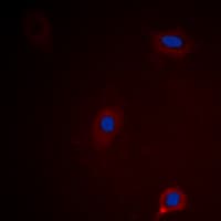 IHC-plus™ ATXN1 / SCA1 Antibody (C-Terminus)
