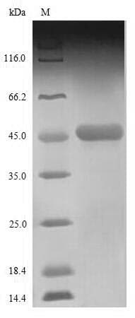 Zaire Ebolavirus Nucleocapsid Protein (Recombinant 6His-SUMO, N-terminus)