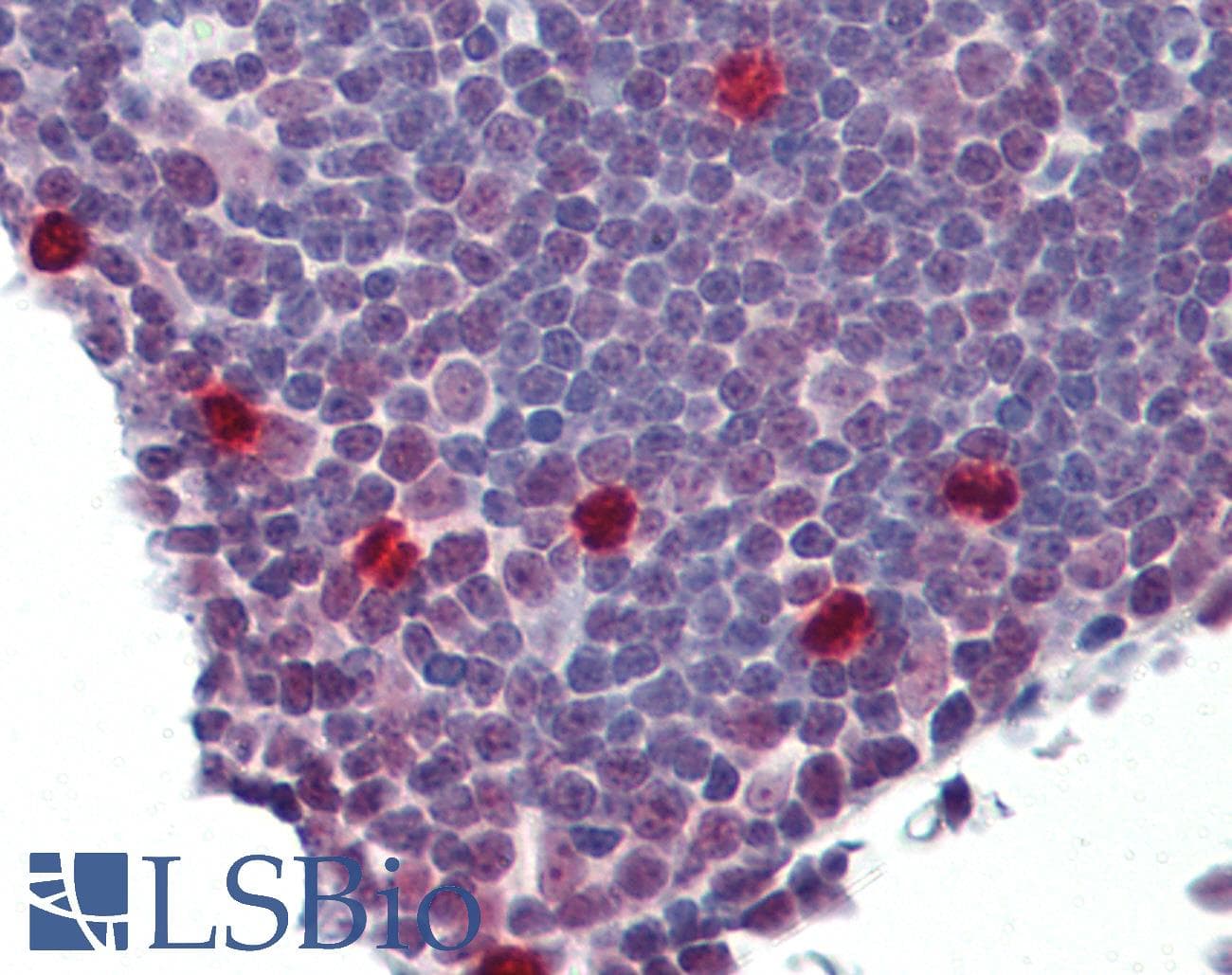 IHC-plus™ PBK / TOPK Antibody (aa1-50)