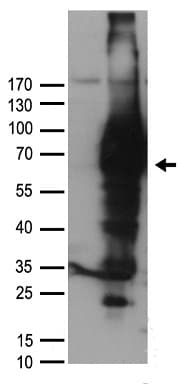 Polyclonal Rabbit anti-Human NGFR / CD271 / TNR16 Antibody (WB)