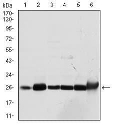 GSTM1 Antibody (clone 1H4A4)