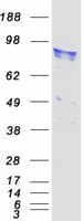 Human P3H1 / LEPRE1 Protein (Recombinant Myc-DDK (Flag))