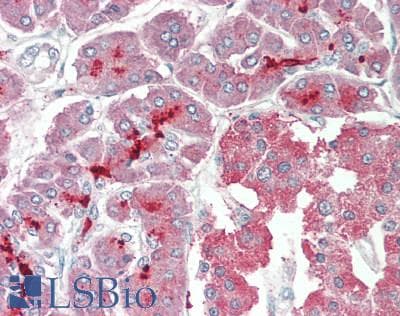 IHC-plus™ ASIC1 / ACCN2 Antibody