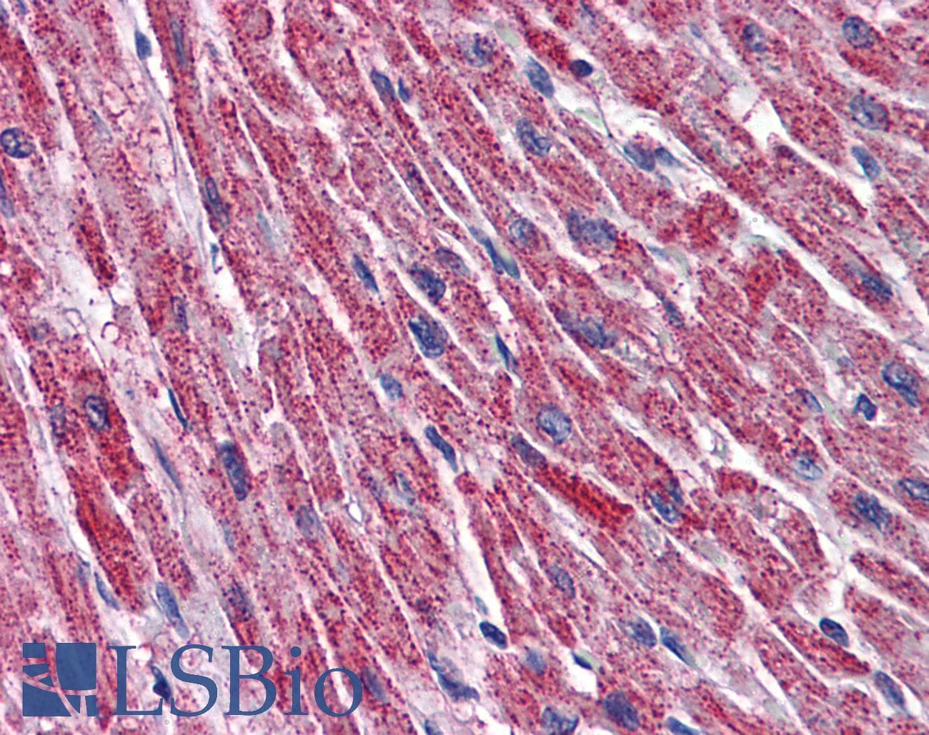 IHC-plus™ DLD / Diaphorase / E3 Antibody (clone 2D4)