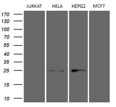 TSN / Translin Antibody (aa1-51, clone OTI1B5)