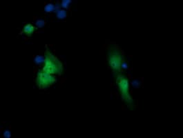 SOLO / SESTD1 Antibody (clone OTI4B10)