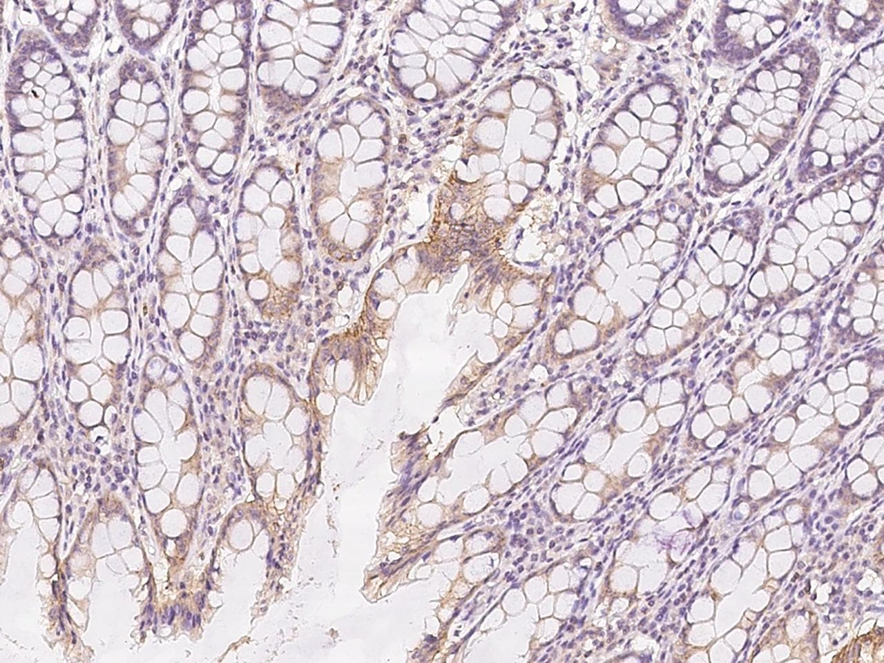 RGL4 Antibody