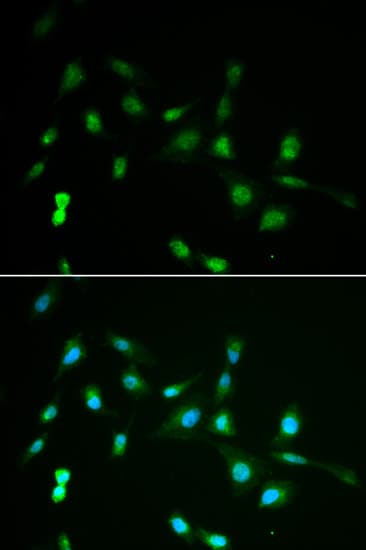 IHC-plus™ HIWI2 / PIWIL4 Antibody