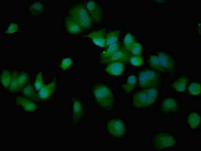 CREBBP / CREB Binding Protein Antibody