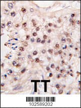 HDAC11 Antibody (aa313-345)