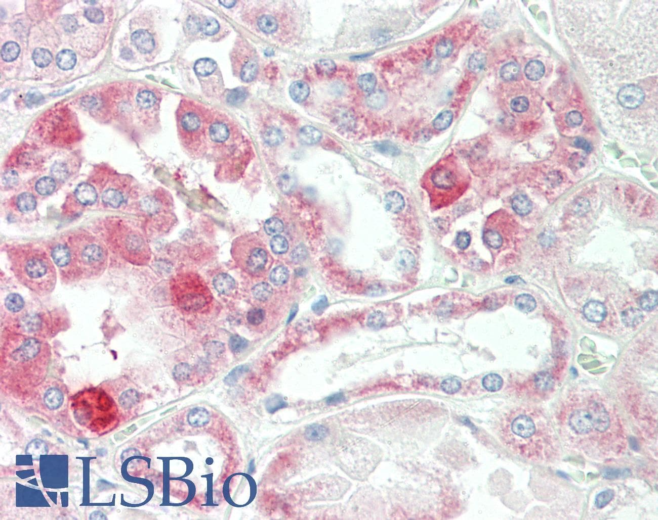 IHC-plus™ ADD3 Antibody (aa431-480)