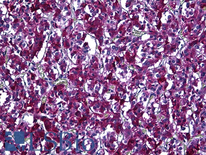 IHC-plus™ Polyclonal Rabbit anti-Human ARHGEF9 / Collybistin Antibody (aa399-448, IHC)