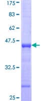 Human NADK / NAD Kinase Protein (Recombinant GST, N-terminus)