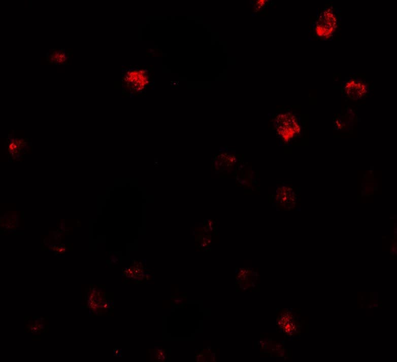 IHC-plus™ Polyclonal Rabbit anti-Human NDST2 Antibody (IHC, IF, WB)